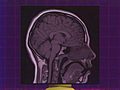 The Player's brain as seen in the Musical Memory tutorial.